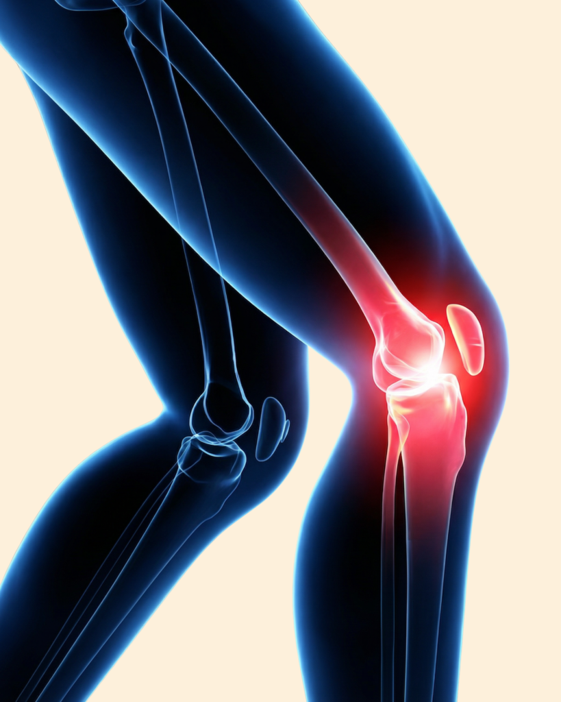 knee surgeries